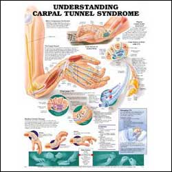 Carpel Tunnel Syndrom